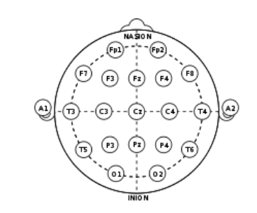 Broadmann Areas - neurofeedback in NYC - types of neurofeedback - brain mapping - biofeedback - 10011 - 10012 Graphic depicting the Broadmann Areas of the brain used during the neurofeedback process. Safe and effective as a treatment for mental health issues, neurofeedback allows your brain to be retrained and function more effectively. Learn more about neurofeedback in NYC here.