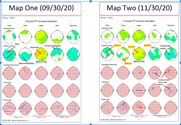 brain maps - neurofeedback in NYC - types of neurofeedback - brain mapping - neurofeedback for ADHD - 10018 - 10010 - 10003 Example of brain maps. Neurofeedback in NYC can help you gain better insight and understanding into how your brain functions. Retraing your brain now!