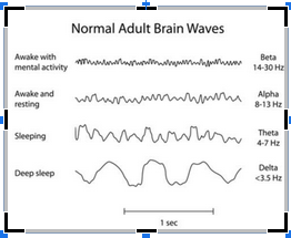 normal adult brainwaves - neurofeedback in NYC - types of neurofeedback - brain mappping - neurofeedback for ADHD - 10011 - 10012 Graph demostrating normal adult brainwaves. Retrain your brain to combat mental health symptoms with neurofeedback in NYC. Learn more here.